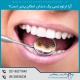 روش های ارتودنسی تک دندان
