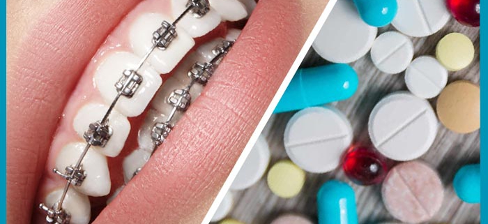 اثر دارو در ارتودنسی دندان