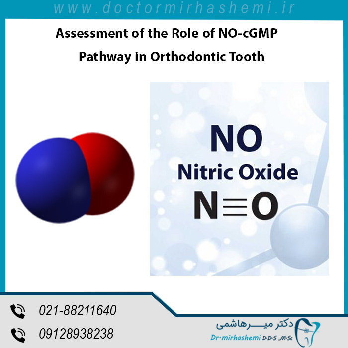 ارزیابی نقش مسیر NO-cGMP در دندان ارتودنسی شده