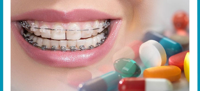 بررسی تأثیر دارو بر سرعت حرکت ارتودنتیک دندان