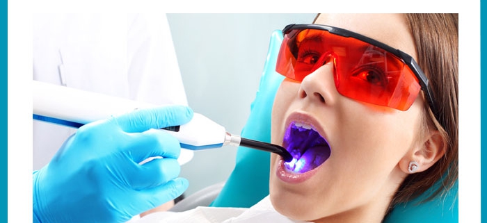 تاثیر پیش درمان سطح مینای دندان با انواع مختلف لیزر و مواد آنتی اکسیدان