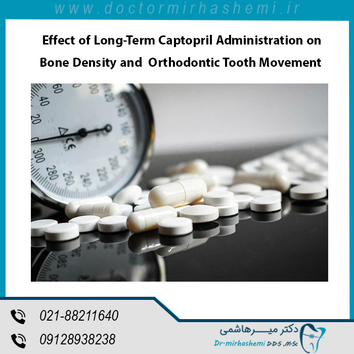 تاثیر مصرف طولانی مدت داروی کاپتوپریل بر تراکم استخوان و حرکت دندان ارتودنسی