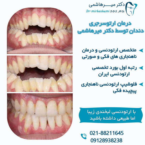 درمان ارتوسرجری دندان