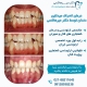 تصاویر درمان انحراف میدلاین دندان