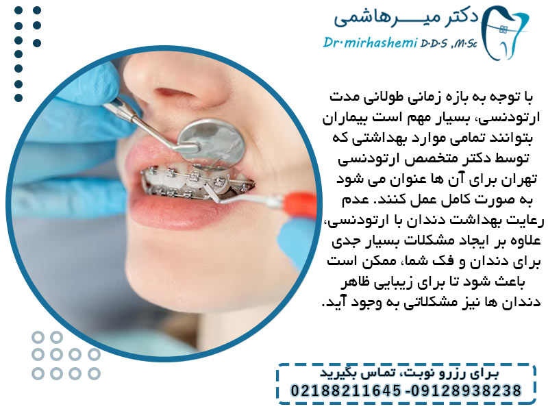 اهمیت بهداشت دهان و دندان در حین و پس از درمان ارتودنسی
