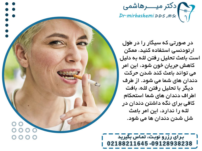 سیگار روی حرکت دندان ها در طول ارتودنسی تاثیر می گذارد