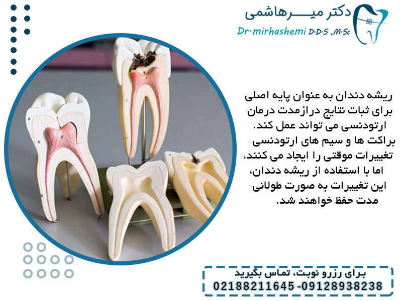 ریشه دندان چه نقشی در درمان ارتودنسی دارد